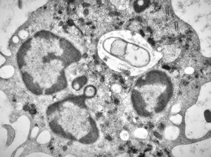 M,2w. | bacteriaemia - phagocytosed microbes M,2w. | bacteriaemia - phagocytosed microbes